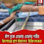 বাঁশ ঢুকে এফোড় ওফোড় শরীর, ময়নাগুড়ির কিশোরের প্রাণ বাঁচালেন জলপাইগুড়ি মেডিকেল কলেজের চিকিৎসকেরা
